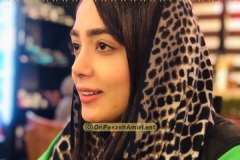 rhinoplasty-35