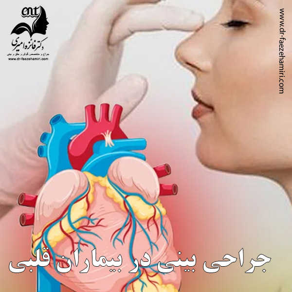 جراحی بینی برای بیماران قلبی - دکتر فائزه امیری