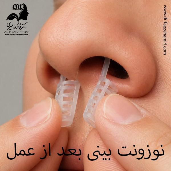 نوزونت بینی بعد از عمل بینی -دکتر فائزه امیری